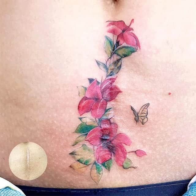 тату цветы на шраме на животе