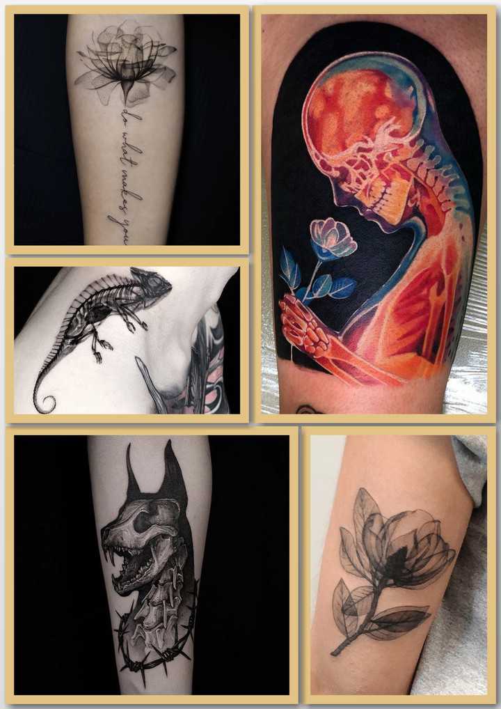 рентген тату