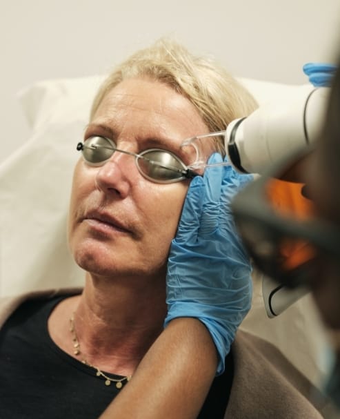 удаление осветление татуажа бровей