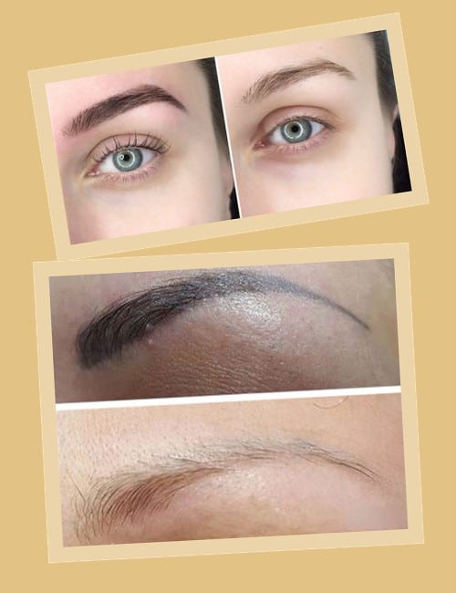 Існує кілька методів для видалення перманентного макіяжу брів