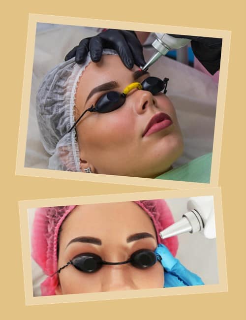 Особливості лазерного видалення татуажу