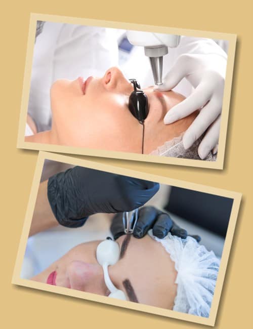 Як прибрати татуаж брів