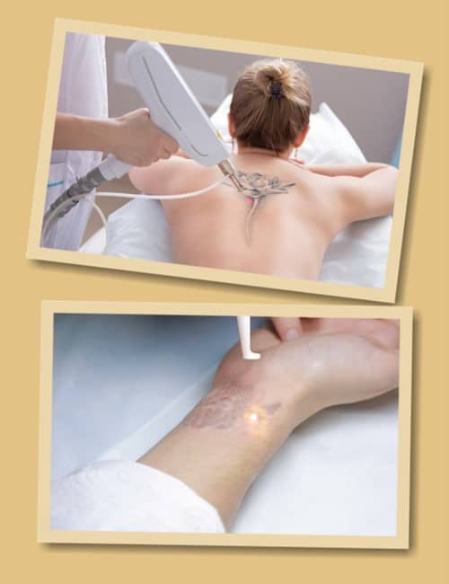 Зведення татуювань