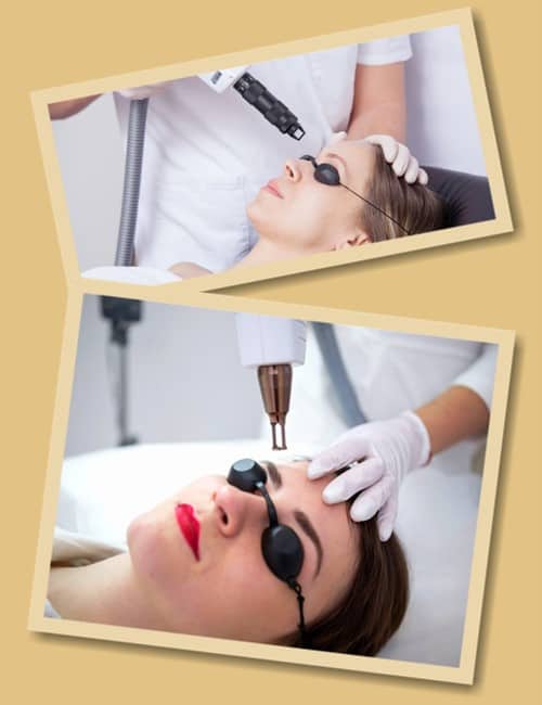 Як видалити татуаж брів