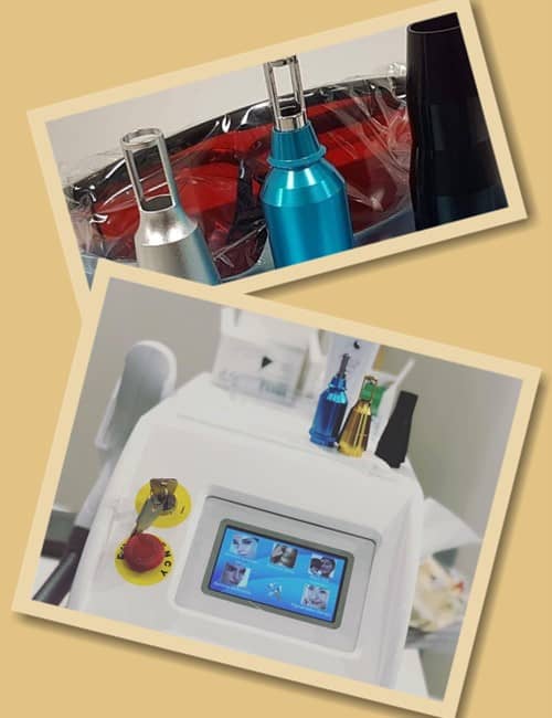 позбутися небажаного татуювання