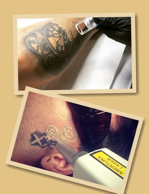 Видалити наколку