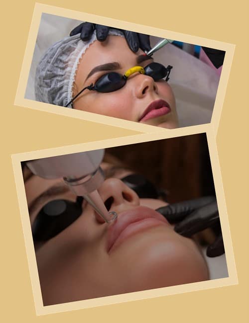 Як видалити татуаж