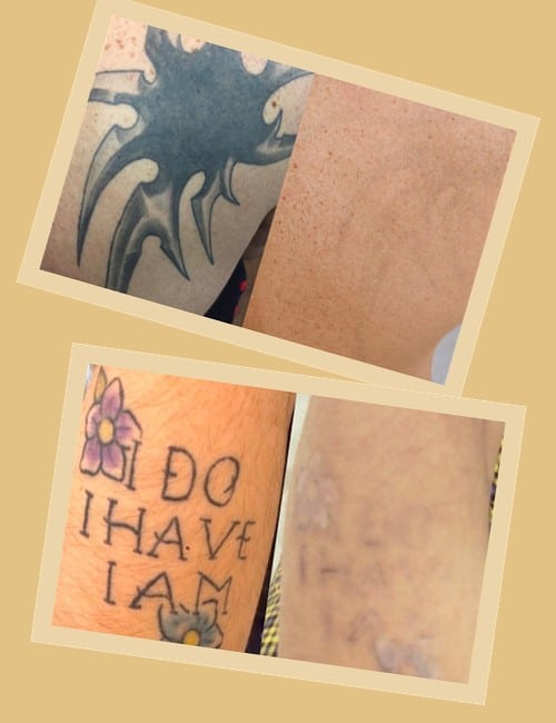 Суть лазерної обробки