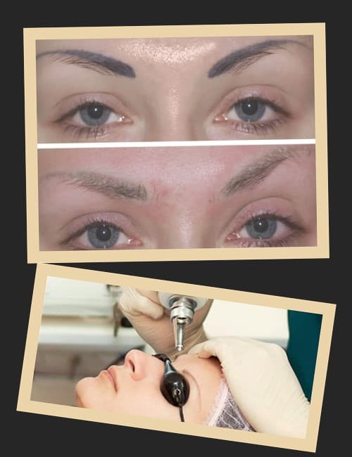 Перманентний макіяж брів видаляють