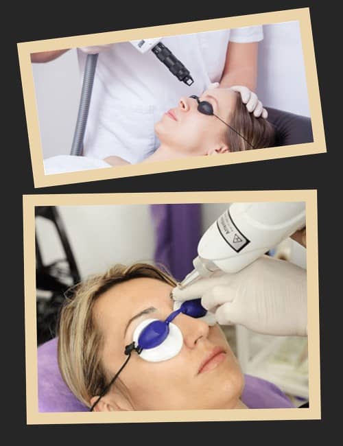 Методи виведення татуажу брів