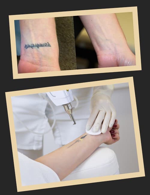 зведення татуювання