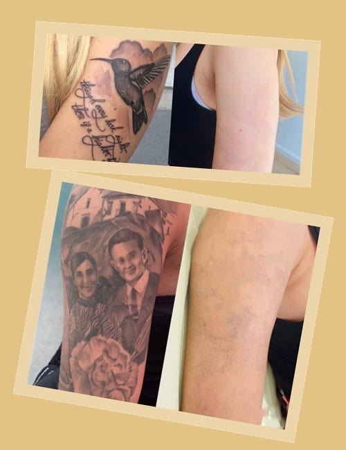 Особливості лазера