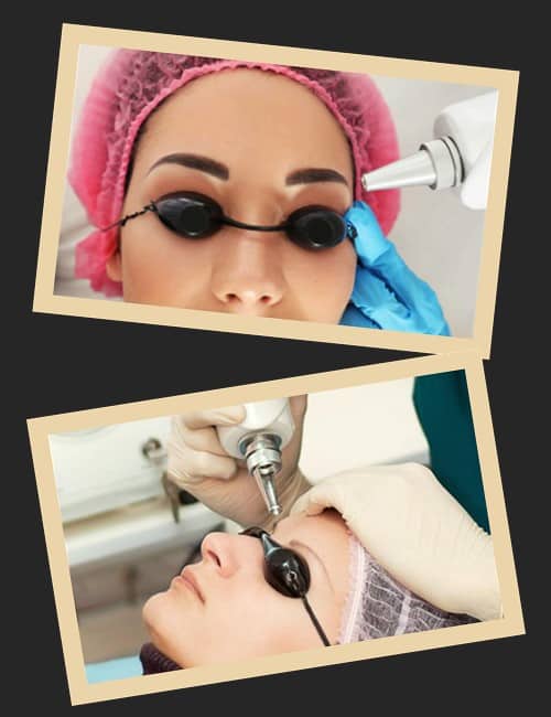 Як проводиться лазерне видалення татуажу