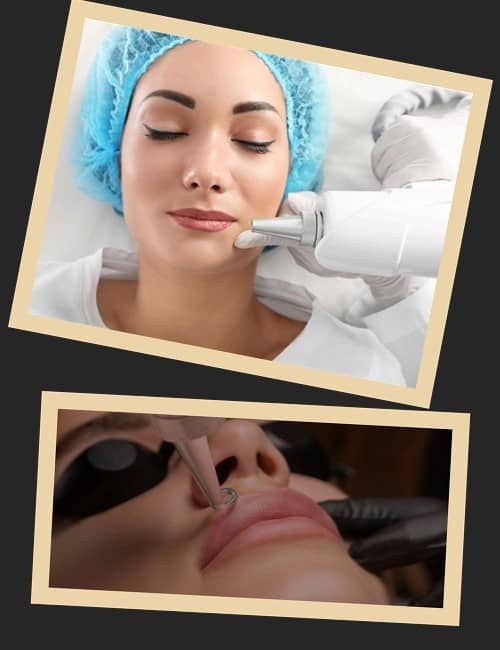 Безпечні методи виведення татуажу