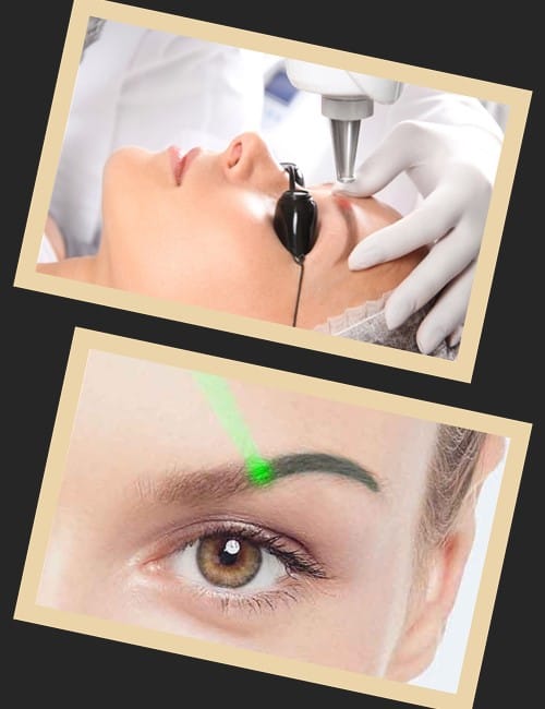 Як позбутися татуажу брів