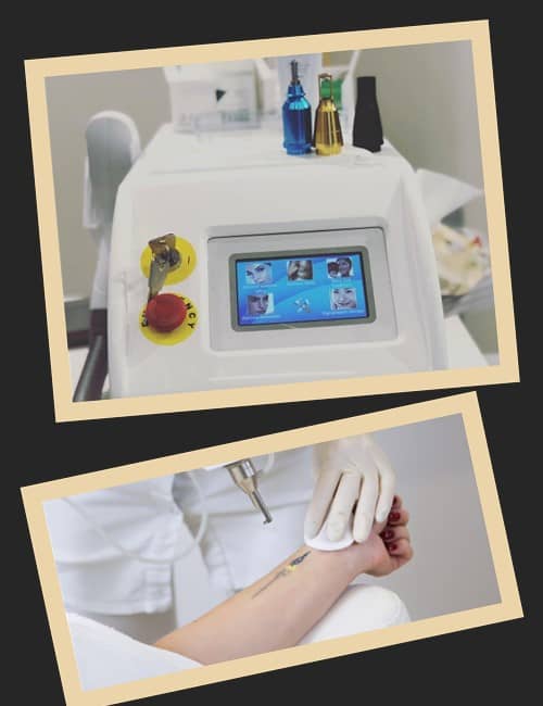 Якими бувають професійні лазери