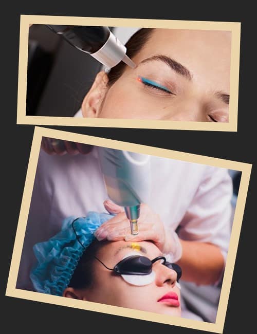 Причини зведення перманента