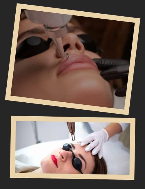 Чому видаляють перманентний макіяж