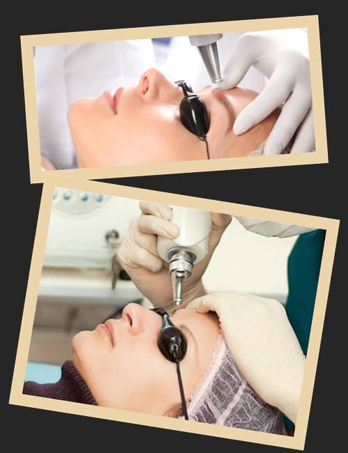 Переваги лазерної методики