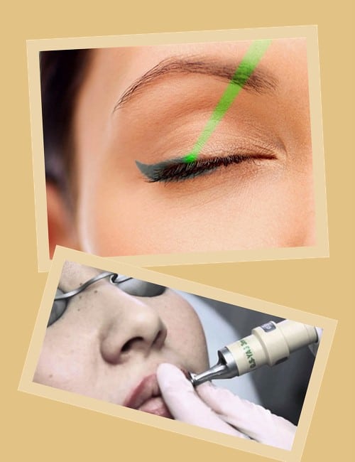 видалити татуаж безпечно