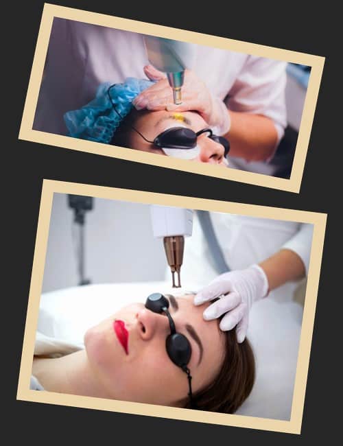 Головні переваги застосування лазера для зняття татуажу