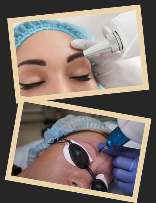 Які методи підходять для виведення перманентного макіяжу