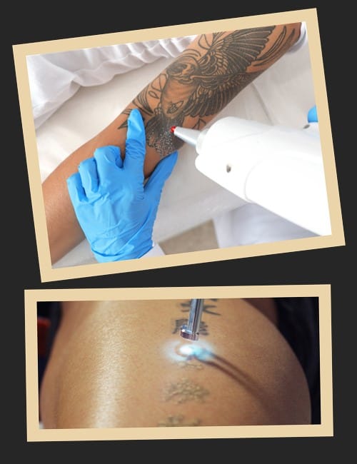 пікосекундні лазери вважаються найбільш ефективними