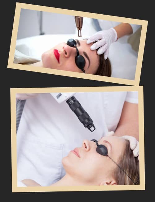 Ефективність лазерного методу видалення татуажу