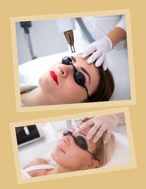 Удалить татуаж бровей