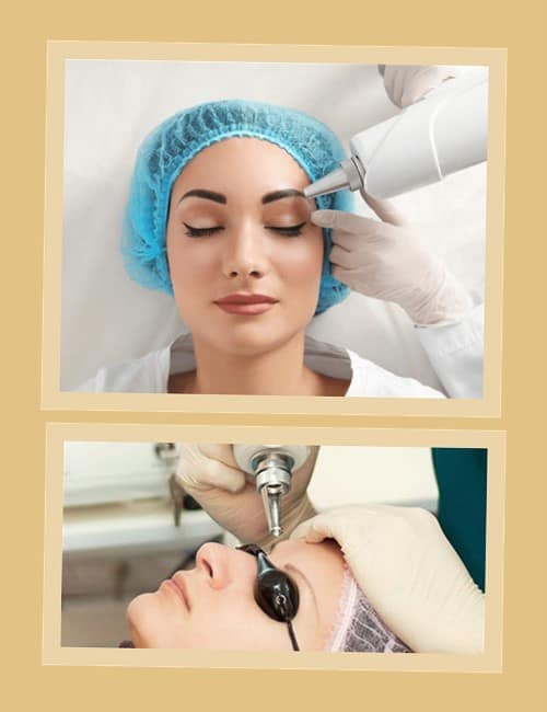 видалити татуаж брів