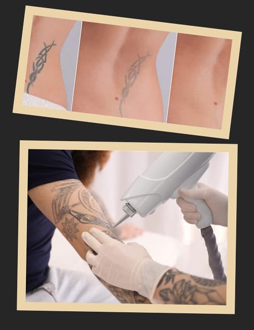 Суть роботи лазера