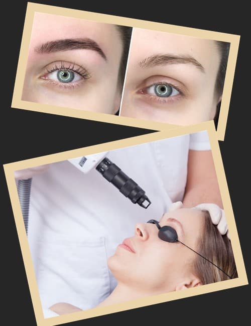 Навіщо видаляти перманентний макіяж