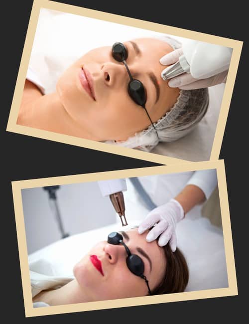 Лазерний спосіб виведення перманентного макіяжу брів