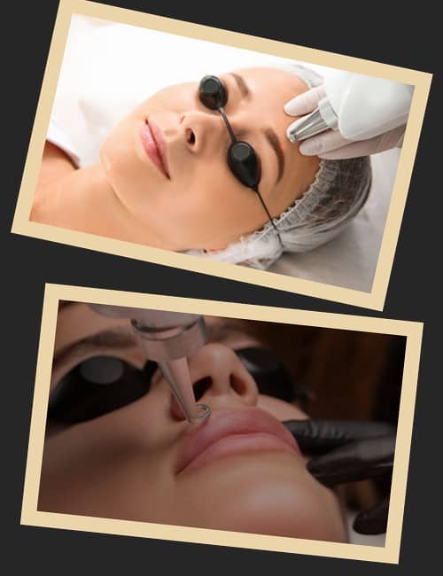 Принцип роботи лазера