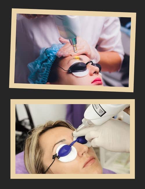 протипоказання лазерного видалення