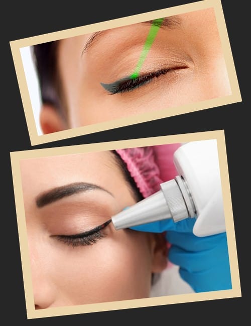 видалення перманентного макіяжу повік