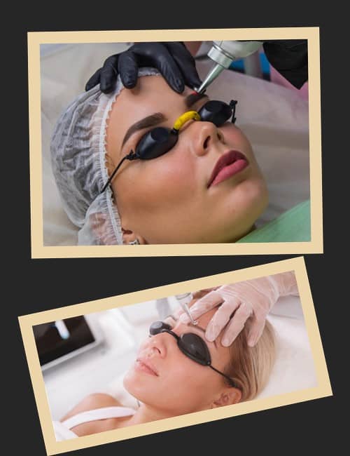 видалити татуаж брів за допомогою неодимового лазера