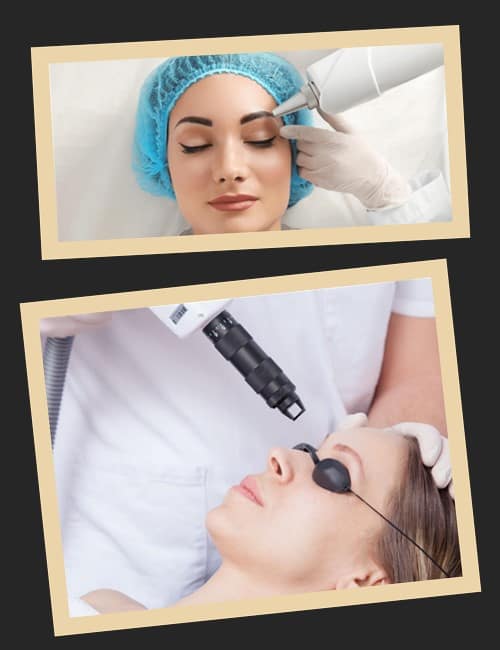 Відновлення брів після лазерної процедури