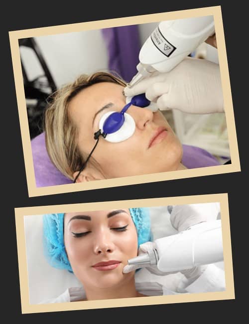 Переваги лазера при видаленні татуажу