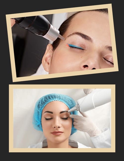 Лазерне зведення перманентного макіяжу має величезний попит