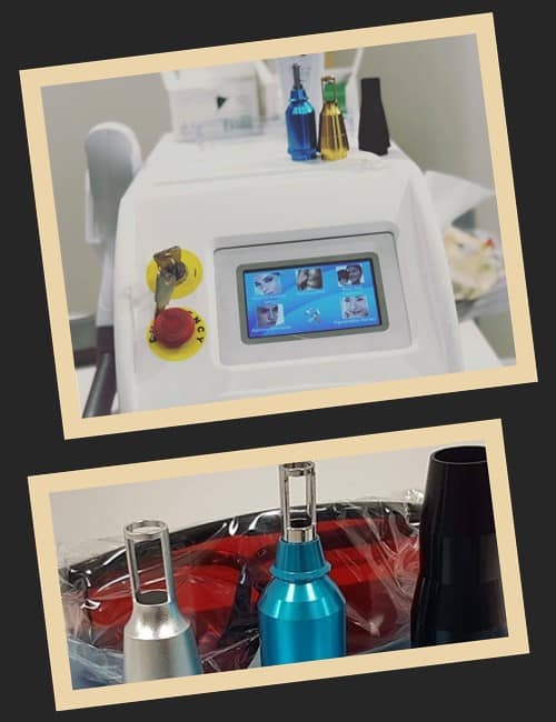 Лазерний метод виведення татуажу