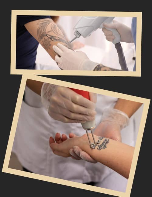 Ефективність лазерної процедури