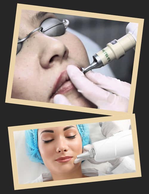 Особливості видалення татуажу губ