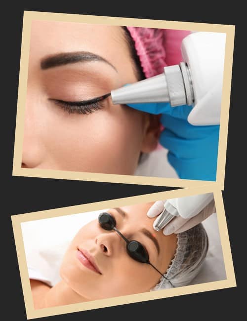 Видалення перманентного макіяжу