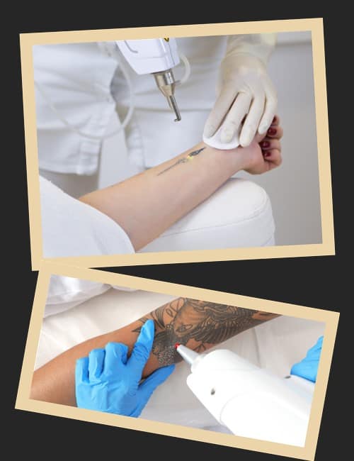 Як краще за все звести татуювання
