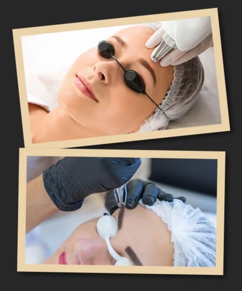 Видалення татуажу брів