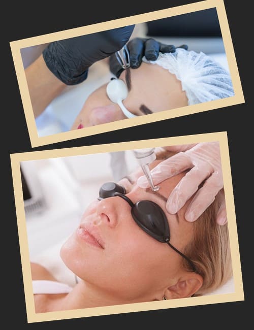 Як вивести невдалий татуаж брів?