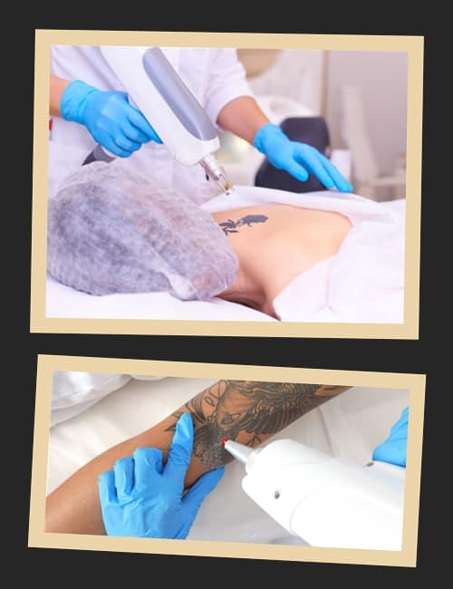 Як можна вивести татуювання