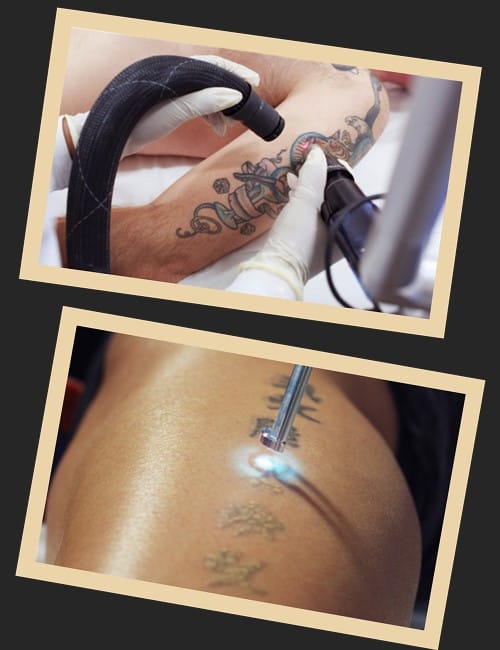 Причини зведення татуювань