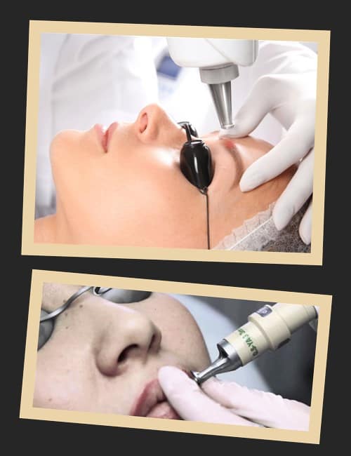 Способи видалення пеманентного макіяжу